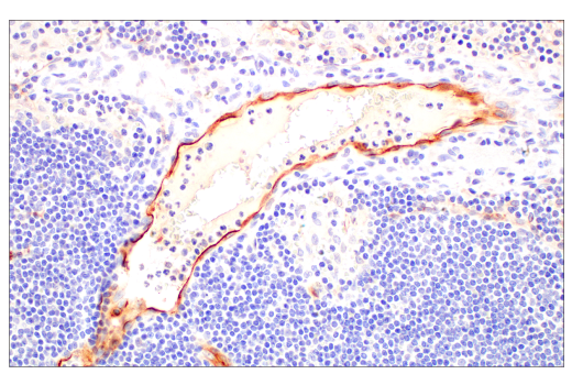 Immunohistochemistry Image 8: PLVAP (E3X9D) Rabbit Monoclonal Antibody