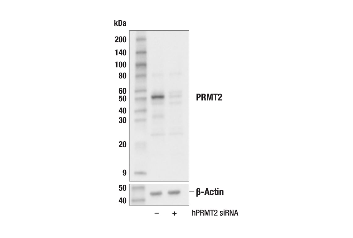 undefined Image 12: PRMT Antibody Sampler Kit