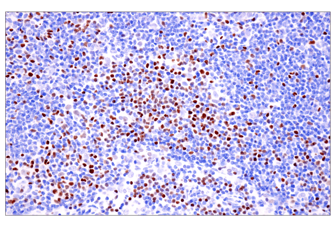 Immunohistochemistry Image 1: TCF1/TCF7 (E6O1K) Rabbit Monoclonal Antibody