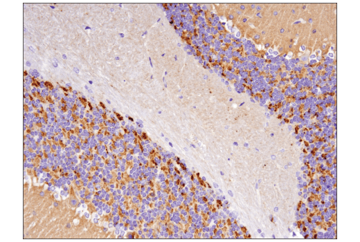 Immunohistochemistry Image 2: Synaptophysin (D8F6H) Rabbit Monoclonal Antibody