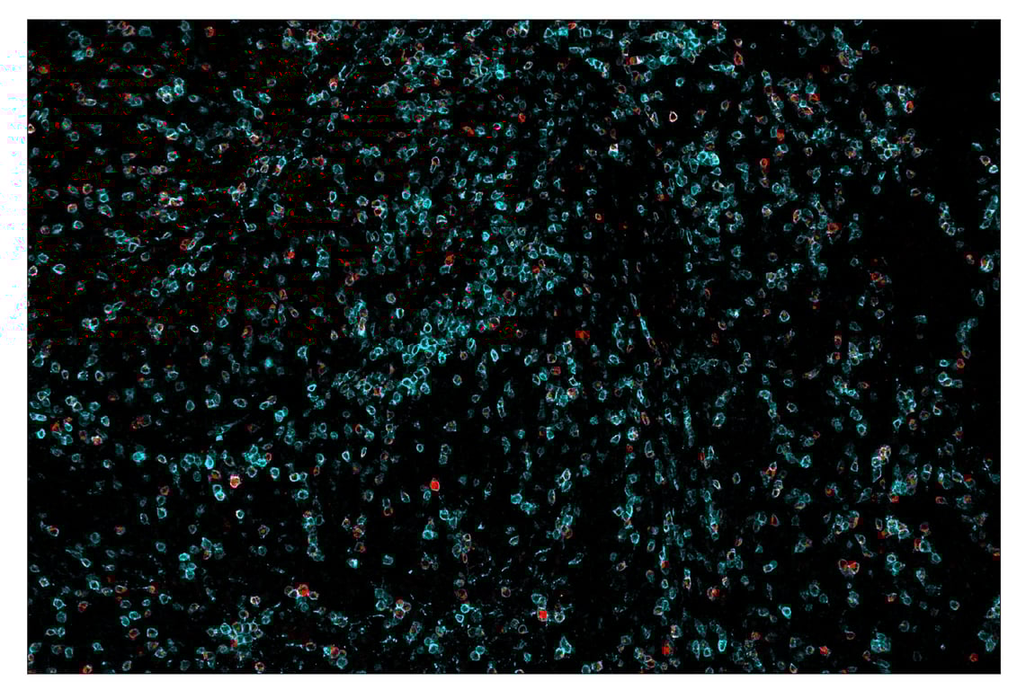 Immunohistochemistry Image 1: LAG3 (D2G4O<sup>™</sup>) & CO-0026-594 SignalStar<sup>™</sup> Oligo-Antibody Pair