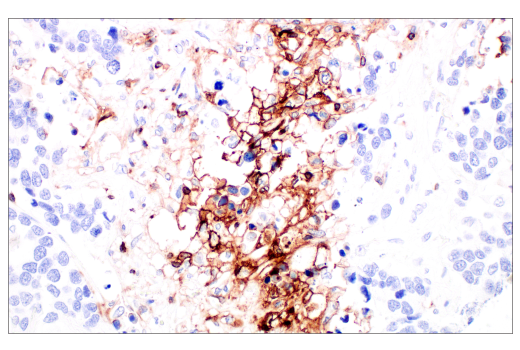 Immunohistochemistry Image 1: Glut3 (E7M7V) Rabbit Monoclonal Antibody