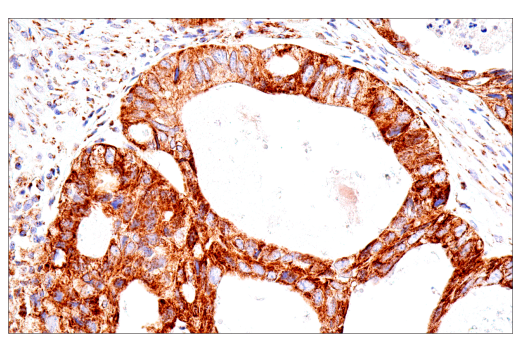 Immunohistochemistry Image 5: SDHB (E3H9Z) Rabbit Monoclonal Antibody