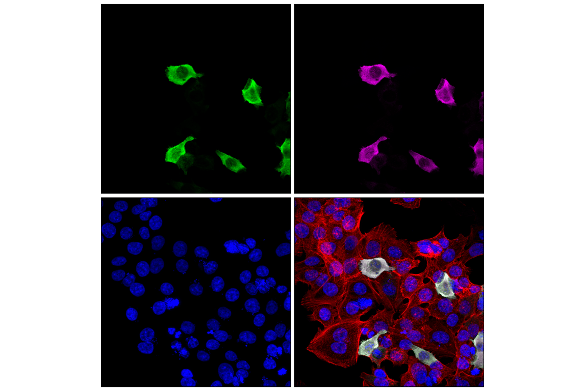 SRLEEELRRRLTE Tag (F8Z6D) Rabbit Monoclonal Antibody (Binds to