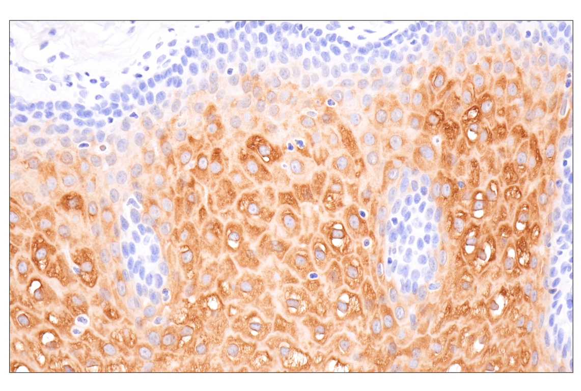 Immunohistochemistry Image 6: Involucrin (F9C3C) Rabbit Monoclonal Antibody