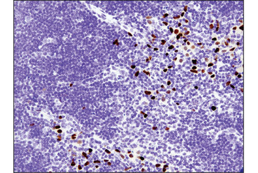 Immunohistochemistry Image 3: SIX1 (D5S2S) Rabbit Monoclonal Antibody