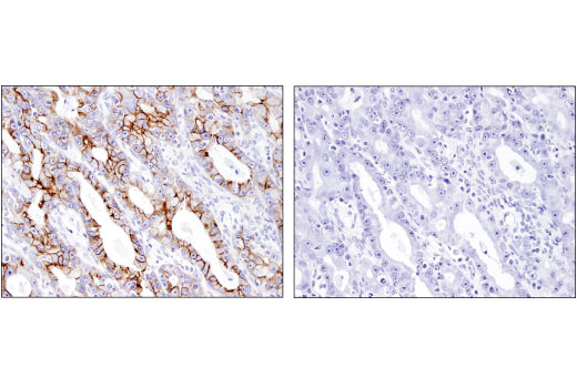 Immunohistochemistry Image 1: EphB2 (D2X2I) Rabbit Monoclonal Antibody