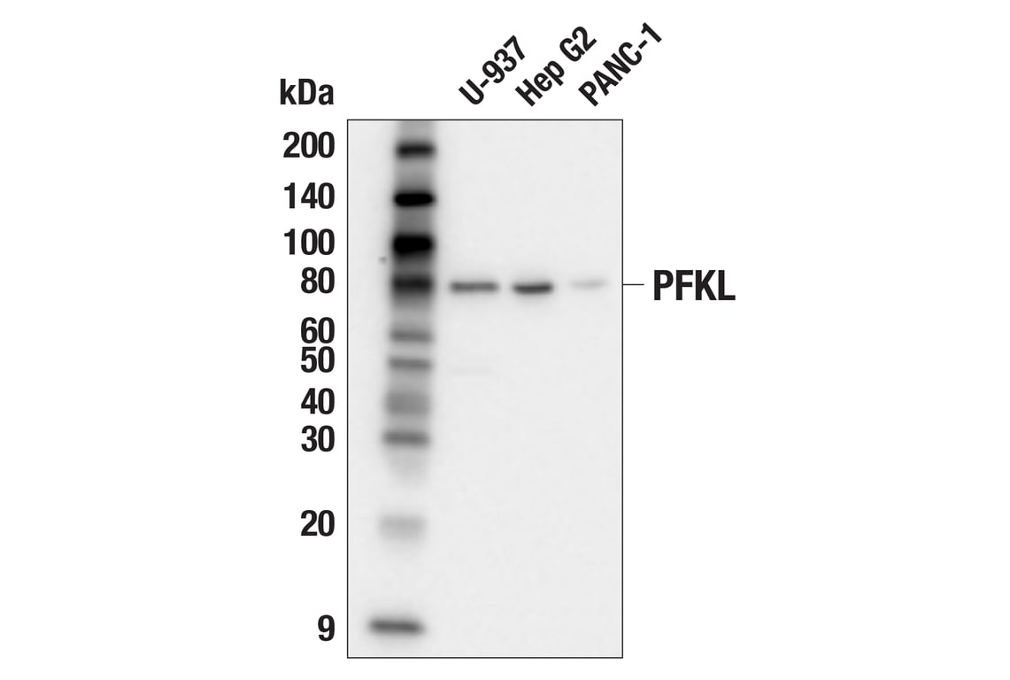 Western Blotting Image 2: PFKL (E7G5O) Rabbit Monoclonal Antibody