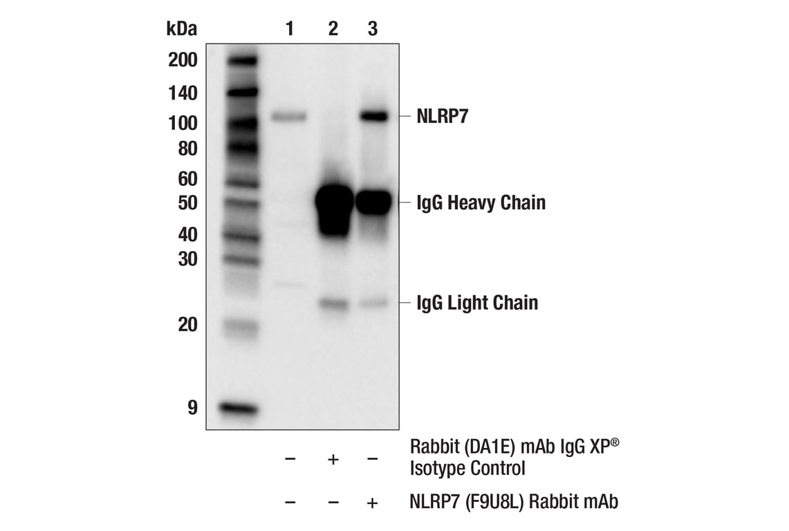 Immunoprecipitation Image 1: NLRP7 (F9U8L) Rabbit Monoclonal Antibody