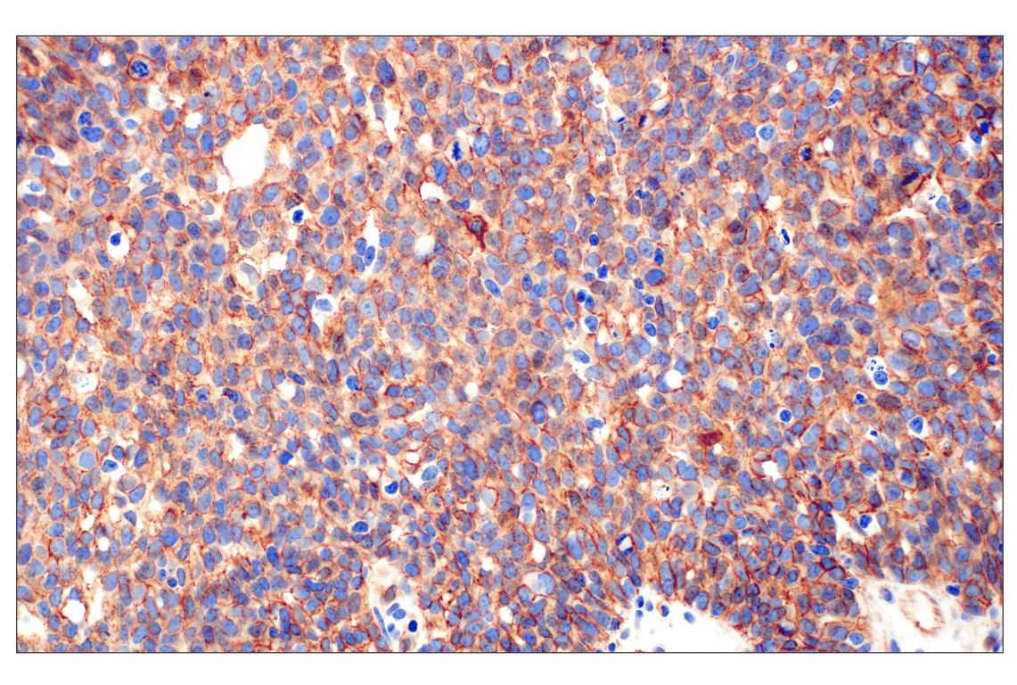 Immunohistochemistry Image 3: beta-Catenin (D10A8) Rabbit Monoclonal Antibody (BSA and Azide Free)