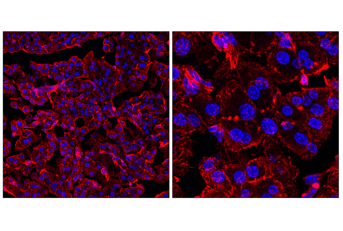 Immunofluorescence Image 1: beta-Actin (13E5) Rabbit Monoclonal Antibody