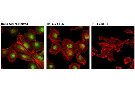 Immunofluorescence Image 1: Stat3 (D1B2J) Rabbit Monoclonal Antibody (BSA and Azide Free)