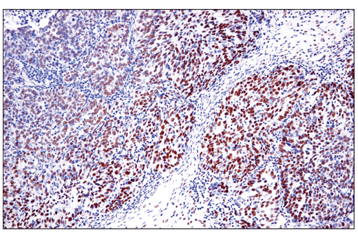 undefined Image 11: PhosphoPlus<sup>®</sup> DNA-PKcs (Ser2056) Antibody Duet