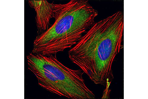 Immunofluorescence Image 1: eIF4G2/p97 (D88B6) XP<sup>®</sup> Rabbit mAb