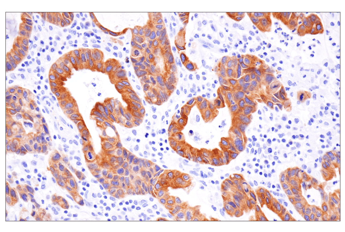 Immunohistochemistry Image 1: KK-LC-1 (F3U6C) Rabbit Monoclonal Antibody (BSA and Azide Free)