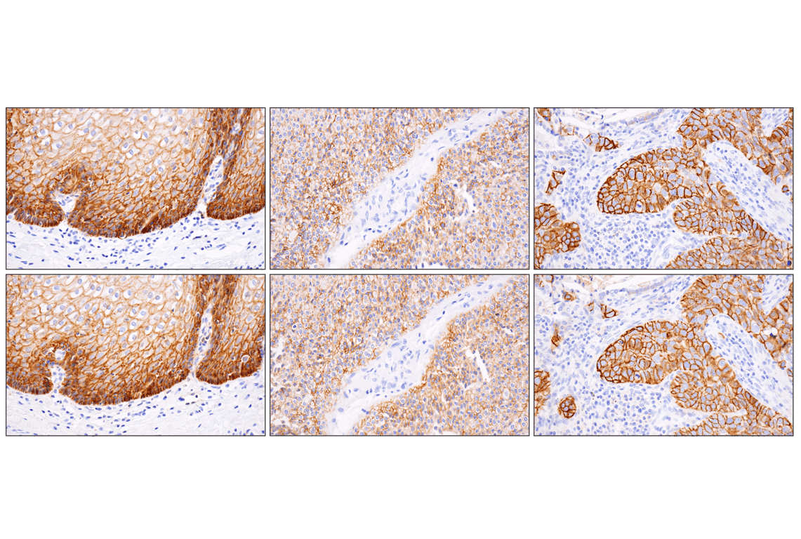 Immunohistochemistry Image 7: CD44 v6 (C44Mab-9) Mouse Monoclonal Antibody