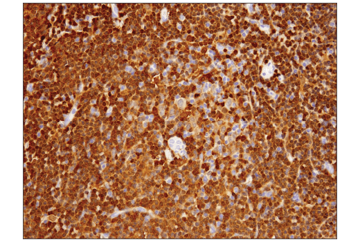 Immunohistochemistry Image 3: Syk (4D10) Mouse Monoclonal Antibody