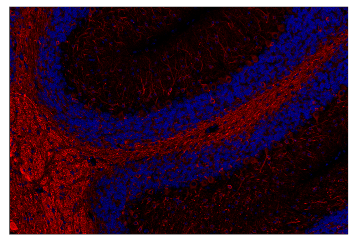 Immunohistochemistry Image 3: beta3-Tubulin (E9F3E) & CO-0128-750 SignalStar<sup>™</sup> Oligo-Antibody Pair