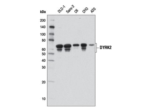 Western Blotting Image 1: DYRK2 (D9A3K) Rabbit mAb