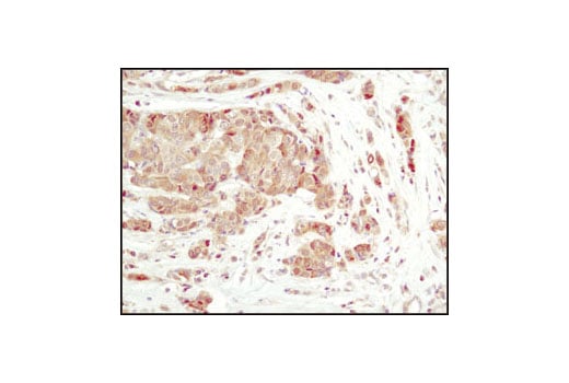 Immunohistochemistry Image 1: PP2C-alpha (D18C10) Rabbit Monoclonal Antibody