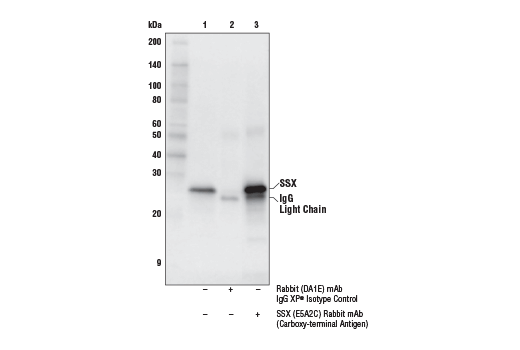 Immunoprecipitation Image 1: SSX (E5A2C) Rabbit Monoclonal Antibody (Carboxy-terminal Antigen)