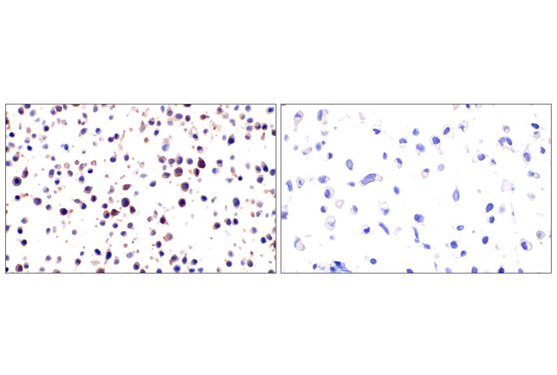 Immunohistochemistry Image 15: FAP (F1A4G) Rabbit mAb