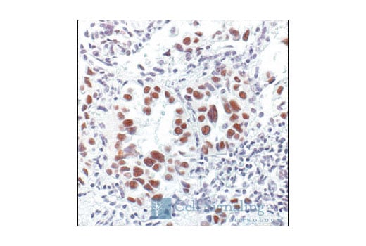 Immunohistochemistry Image 1: TFII-I Antibody