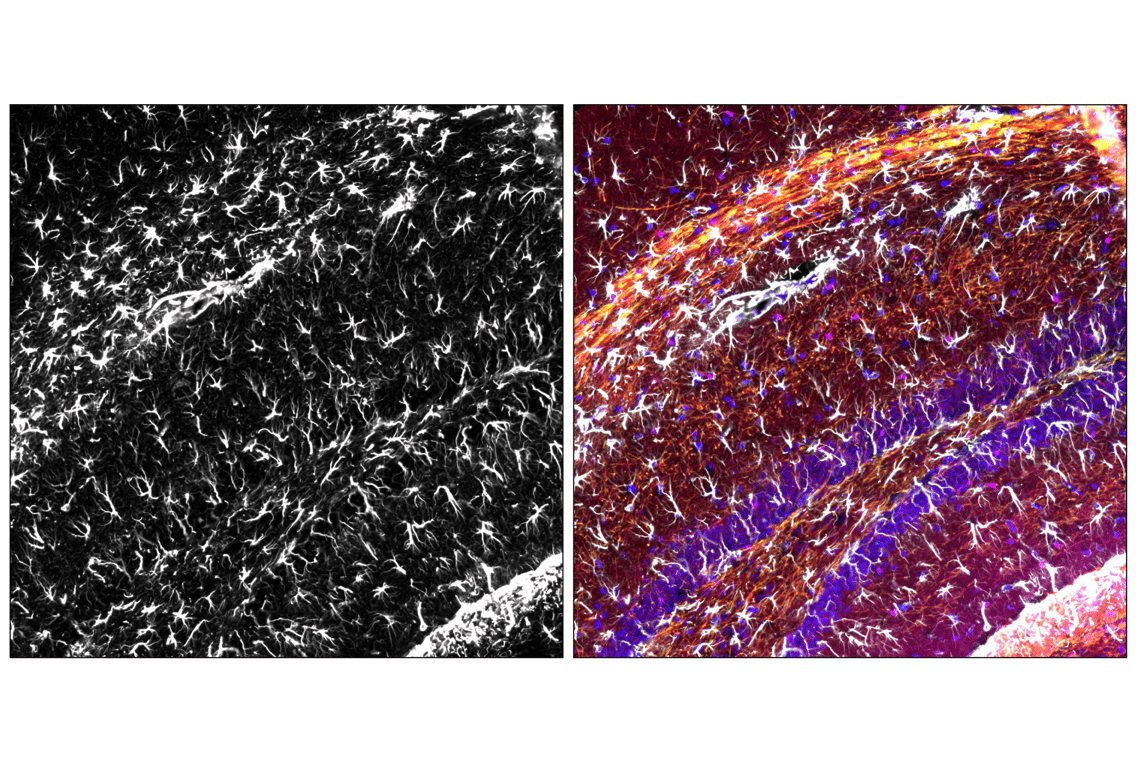 Immunofluorescence Image 4: GFAP (E4L7M) Rabbit Monoclonal Antibody (Alexa Fluor<sup>®</sup> 488 Conjugate)