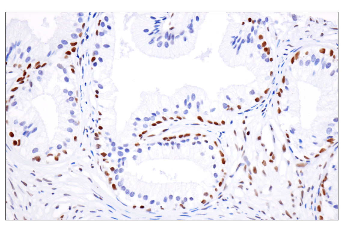 Immunohistochemistry Image 4: Acetyl-Histone H4 (Lys16) (E2B8W) Rabbit Monoclonal Antibody
