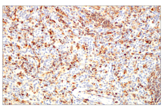 Immunohistochemistry Image 4: CD74 (D5N3I) Rabbit Monoclonal Antibody