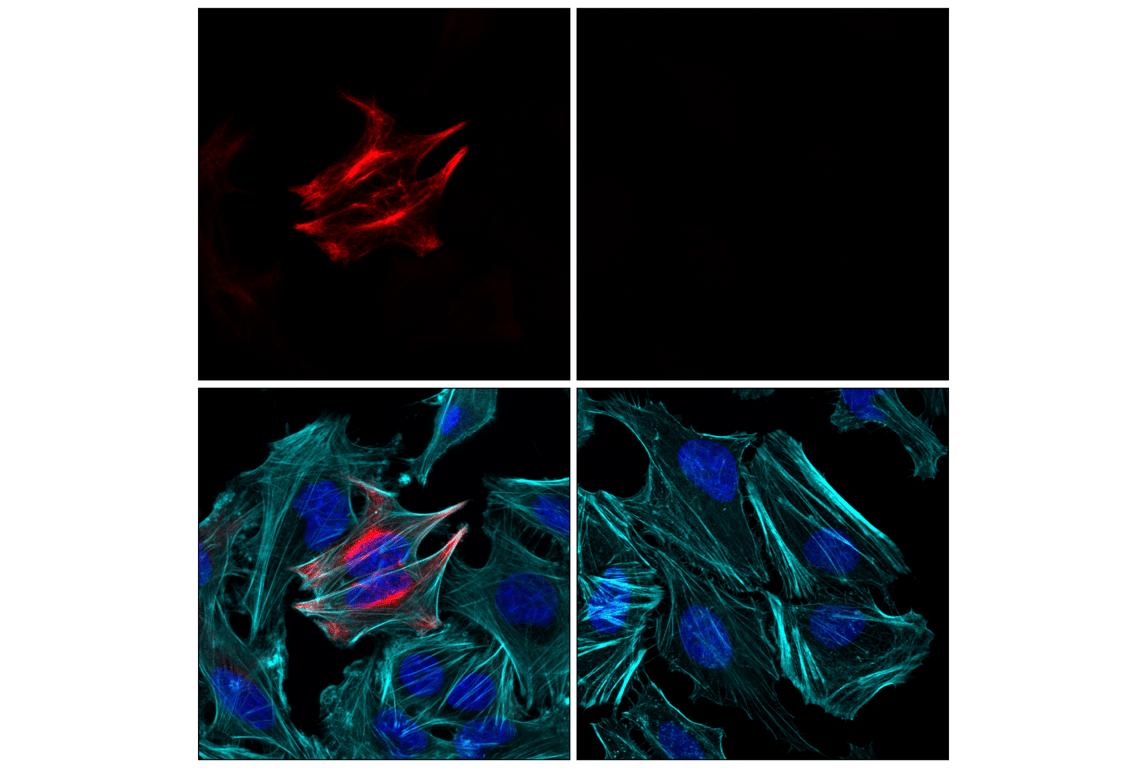Immunofluorescence Image 1: GFAP (E4L7M) Rabbit Monoclonal Antibody (Alexa Fluor<sup>®</sup> 594 Conjugate)
