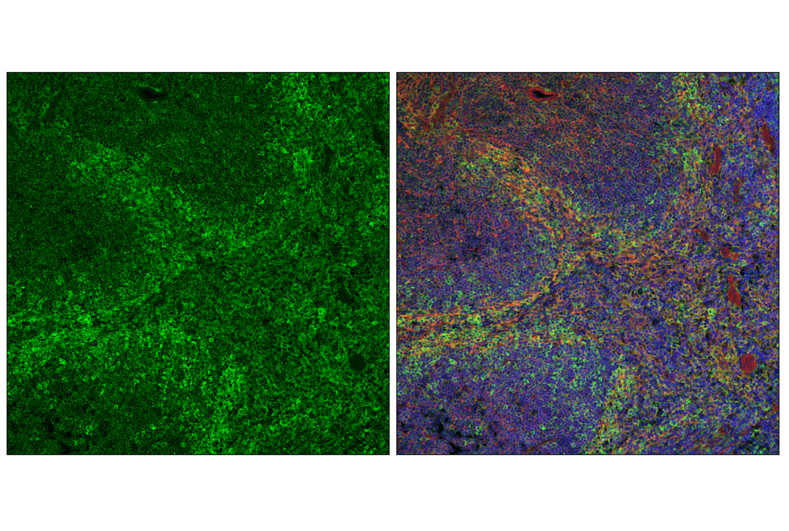 undefined Image 22: Actin Reorganization Antibody Sampler Kit