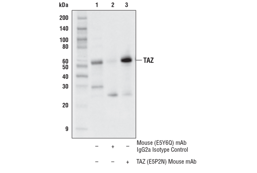 Immunoprecipitation Image 1: TAZ (E5P2N) Mouse Monoclonal Antibody