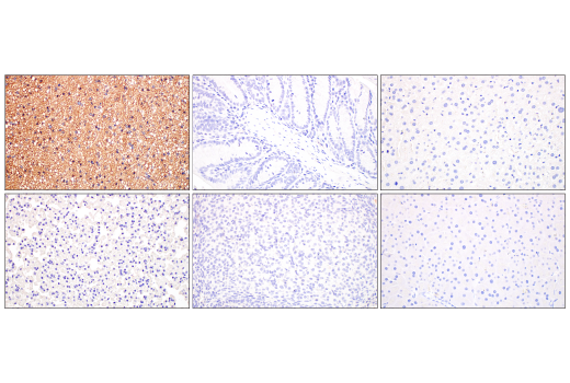 Immunohistochemistry Image 1: UCP1 (E9Z2V) Rabbit Monoclonal Antibody