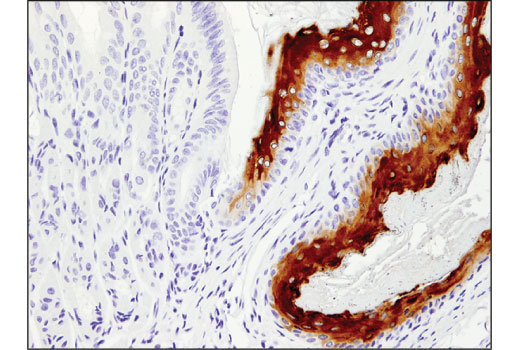 Immunohistochemistry Image 10: HSP27 (E1J4D) Rabbit Monoclonal Antibody