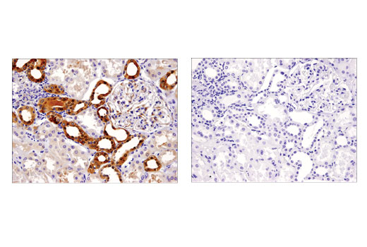 Immunohistochemistry Image 3: COMT (D4N6M) Rabbit Monoclonal Antibody (BSA and Azide Free)