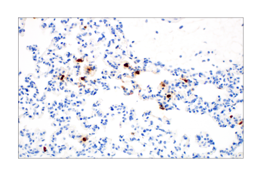 Immunohistochemistry Image 5: S100A9 (D3U8M) Rabbit Monoclonal Antibody