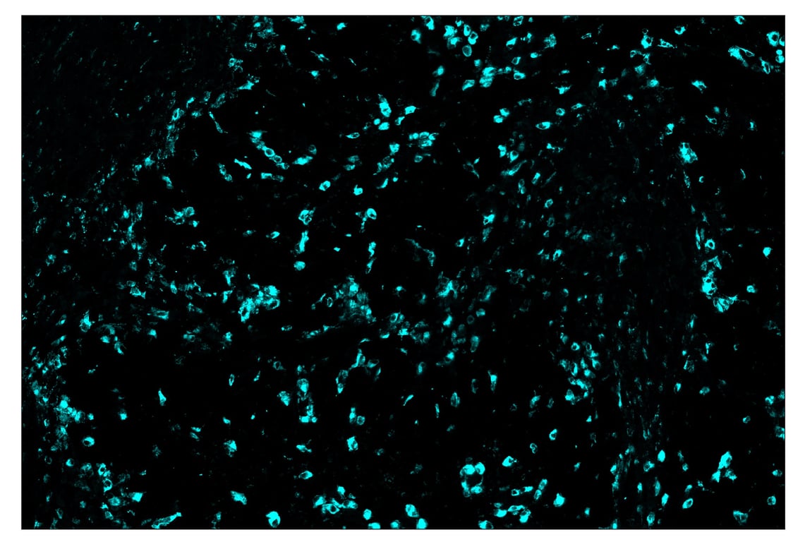 Immunohistochemistry Image 5: CD68 (D4B9C) & CO-0007-647 SignalStar<sup>™</sup> Oligo-Antibody Pair