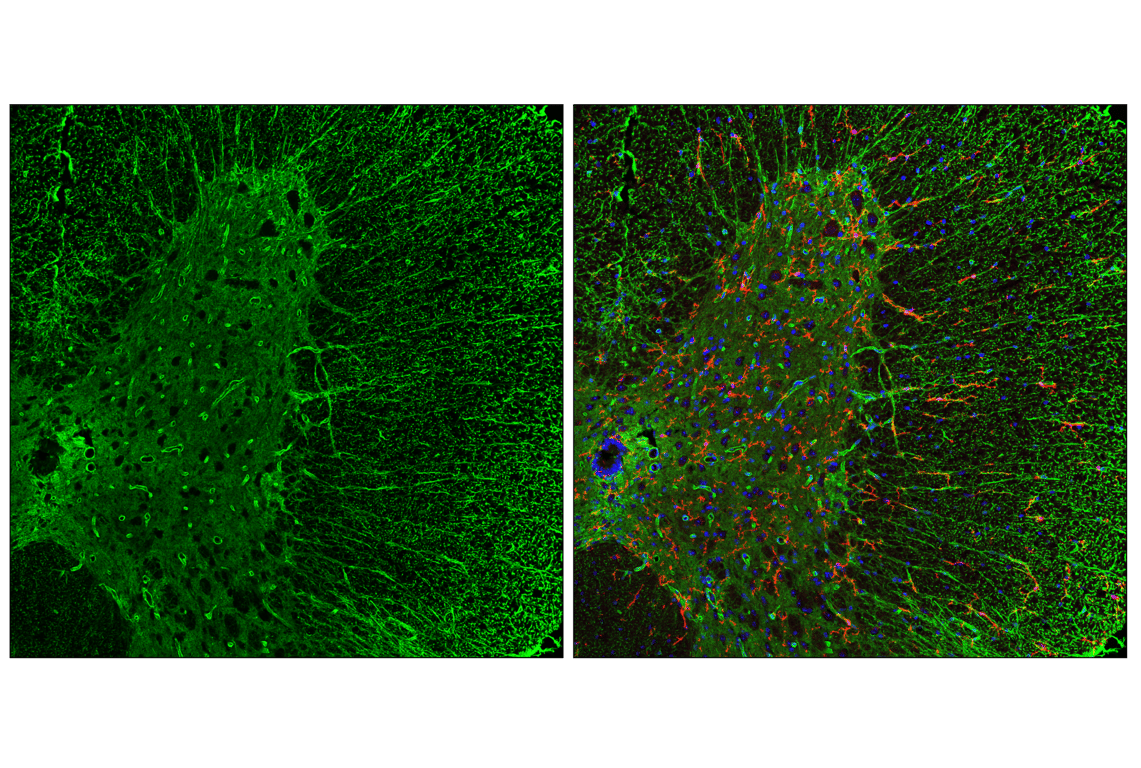 Immunofluorescence Image 2: AQP4 (E8W5A) Mouse Monoclonal Antibody