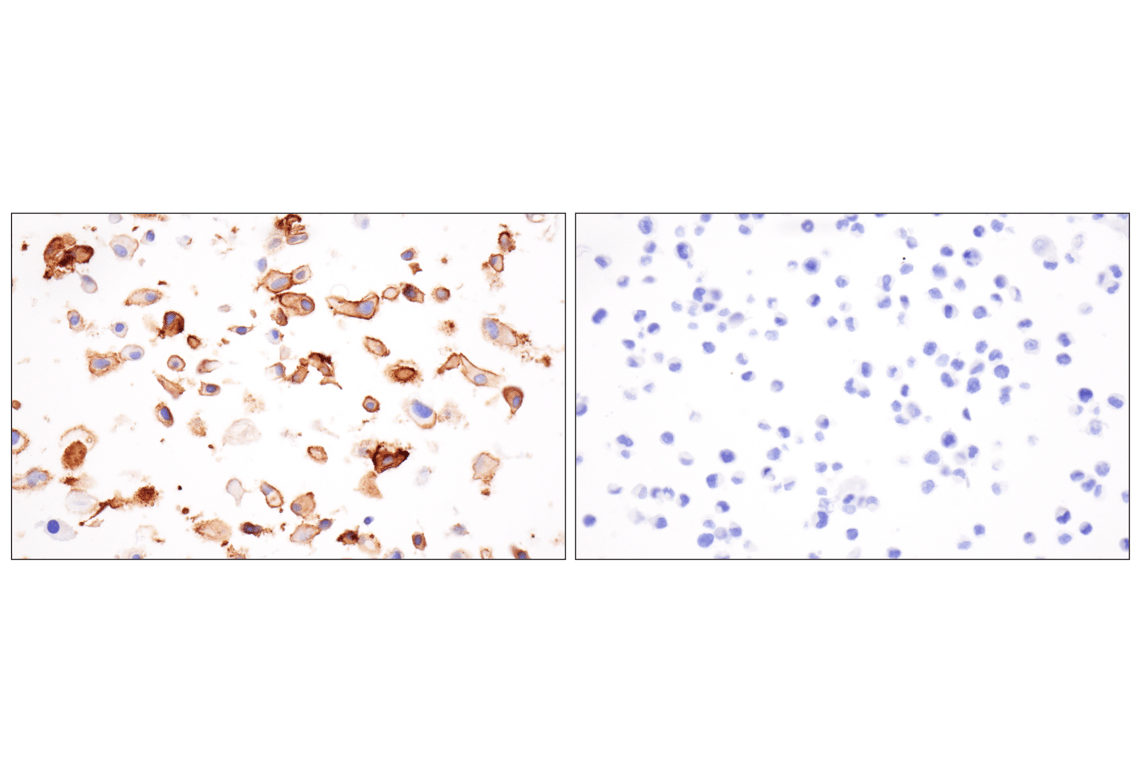 Immunohistochemistry Image 11: LRRC15 (E4X8J) Rabbit Monoclonal Antibody