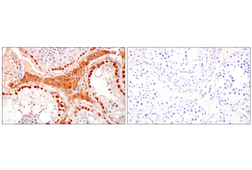 undefined Image 31: Gluconeogenesis Antibody Sampler Kit