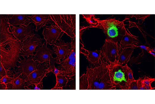 Immunofluorescence Image 1: HA-Tag (6E2) Mouse mAb (Alexa Fluor<sup>®</sup> 488 Conjugate)