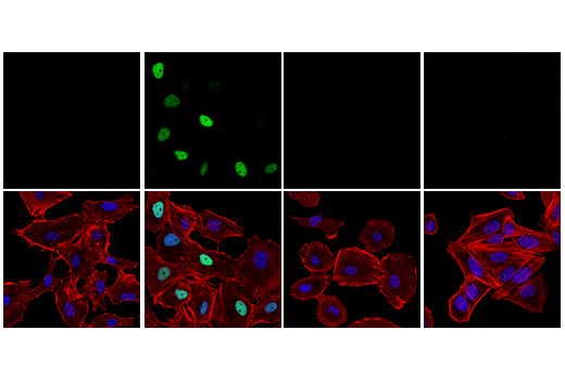 Immunofluorescence Image 1: Phospho-p53 (Ser15) (E9Y4U) Rabbit Monoclonal Antibody