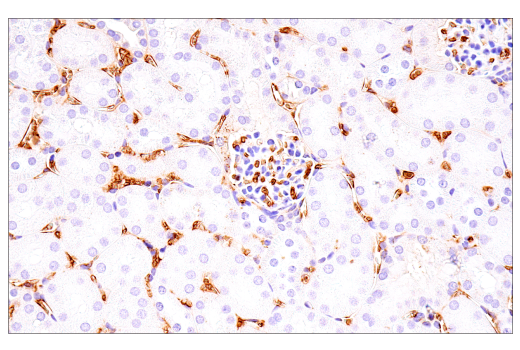undefined Image 39: Genetics of Parkinson's Disease: Lysosomal Dysfunction Antibody Sampler Kit