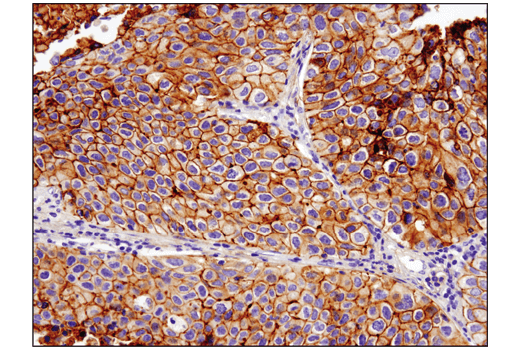 Immunohistochemistry Image 1: B7-H3 (D9M2L) Rabbit Monoclonal Antibody (BSA and Azide Free)
