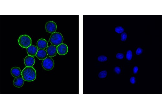 Immunofluorescence Image 1: HER2/ErbB2 (29D8) Rabbit Monoclonal Antibody (BSA and Azide Free)