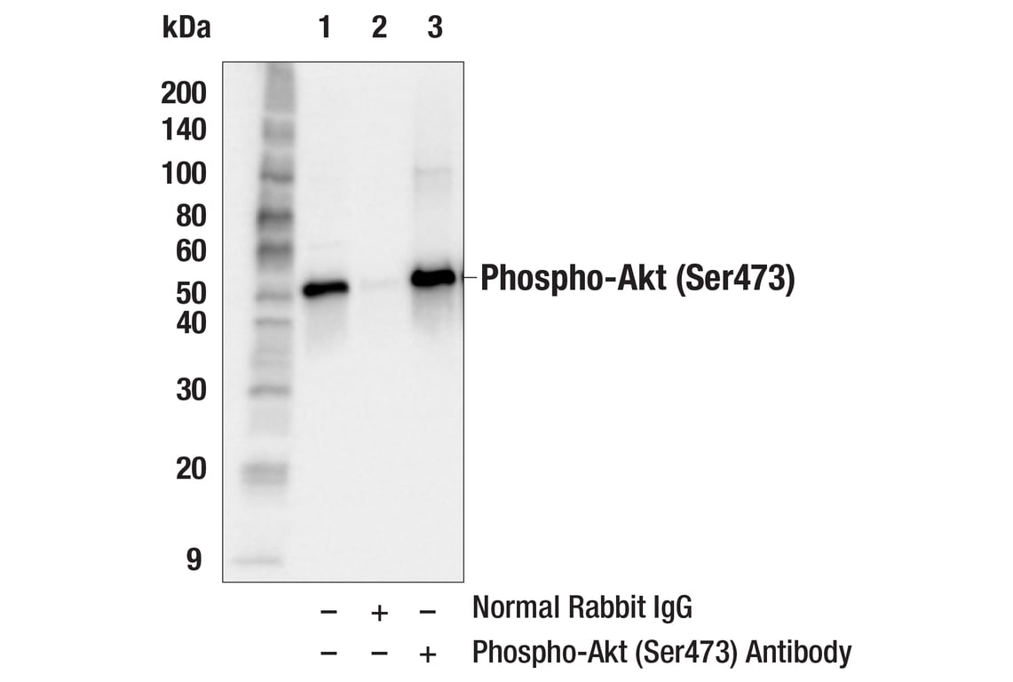 Immunoprecipitation Image 1: Phospho-Akt (Ser473) Antibody