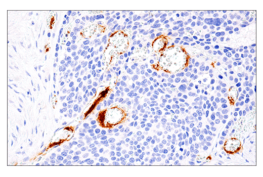 Immunohistochemistry Image 4: DNAM-1/CD226 (E8L9G) Rabbit Monoclonal Antibody