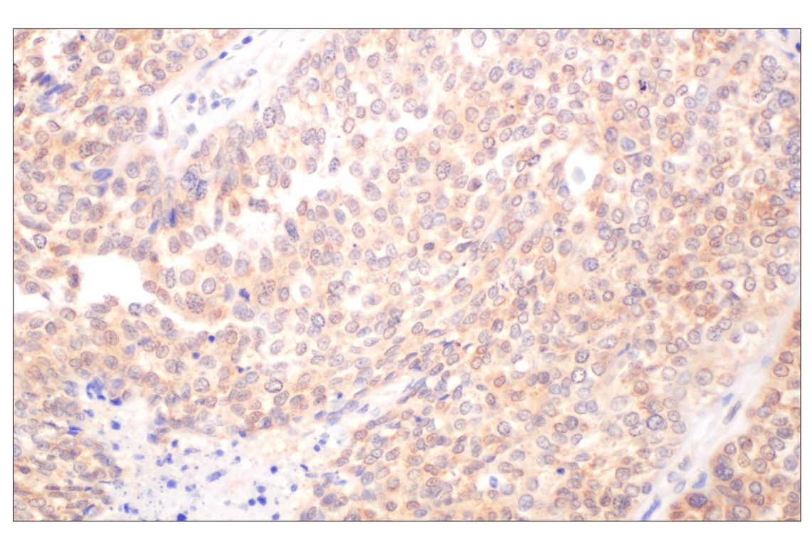 Immunohistochemistry Image 7: Galectin-8/LGALS8 (F9O3T) Rabbit Monoclonal Antibody