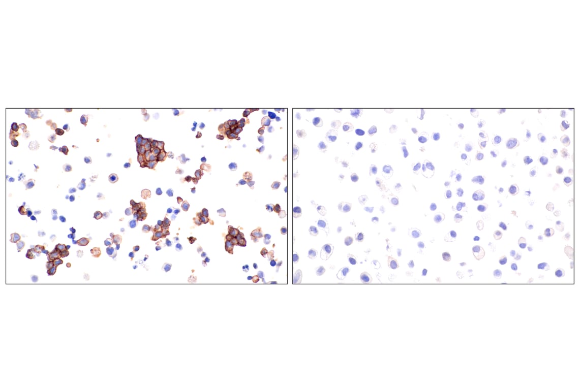 Immunohistochemistry Image 9: Claudin-5 (E5D9Y) Rabbit Monoclonal Antibody (BSA and Azide Free)